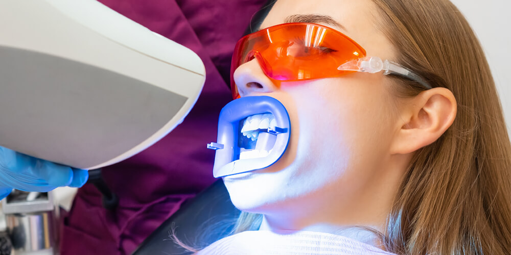 Teeth Whitening Etobicoke