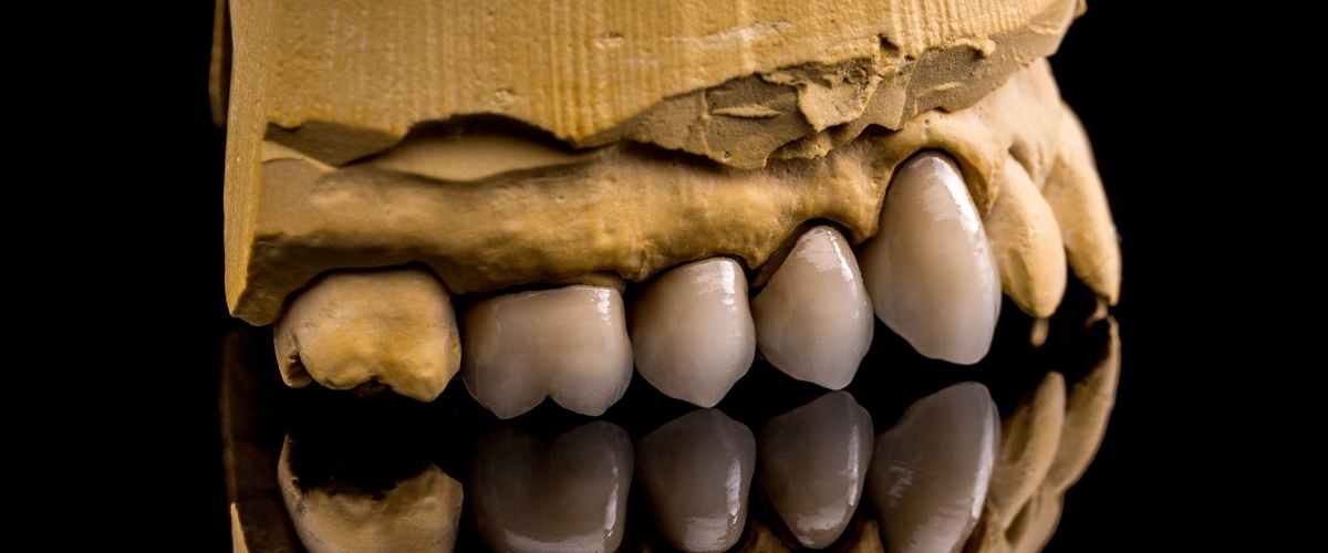 Don’t Wait for the Ache: Why Timing is Everything for Wisdom Teeth